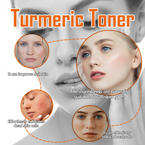 West&Month 100ml Dark Spots Removal Toner Turmeric Deep Hydration Lighten Melasma Remove Freckle Moisturizing Facial Skin Toner