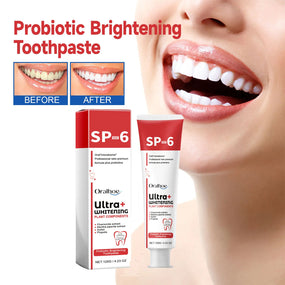 Oralhoe 120g Sp6 Probiotic Brightening Toothpaste Oral Hygiene Clean Fresh Breath Odor Stain Remove Ultra Whitening Toothpaste