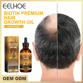 Ginger Hair Serum Moisturizing And Repairing Thicken Biotin Essential Oils Anti-drying Baldness Cleansing Treatment Hair Care